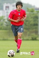 광대뼈골절수술3