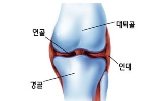 프리미엄조인트2
