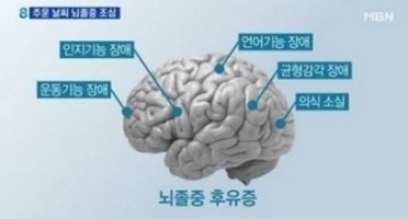 [공지]뇌경색 예방법 무섭네요