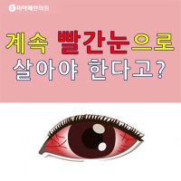 눈이빨개요5