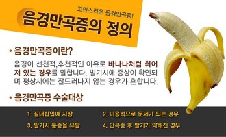 고추가휘었어요3