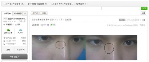 대전성형외과추천3