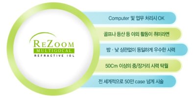 백내장수술방법2