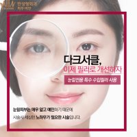 다크서클성형3
