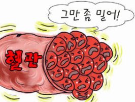고혈압, 고혈압을 식생활 습관으로 다스릴 수 있다.