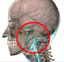 뒷머리가아파요1
