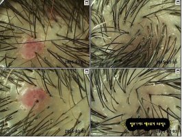두피관리사자격증4
