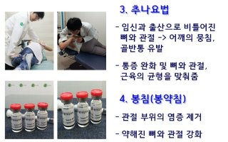 산후풍증상3