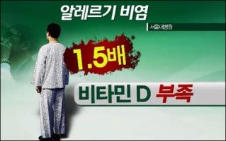 비타민 D 부족, 알레르기 비염 유발?