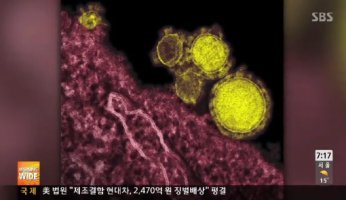 메르스 전염병 공포 전세계 확산 152명 사망..사스와 유사