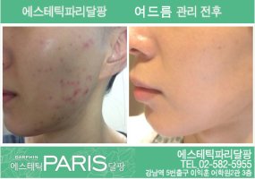 강남역피부관리실2