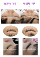 속눈썹증모술3