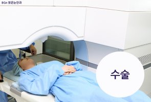 원데이라식수술6