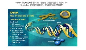 녹내장수술비용4