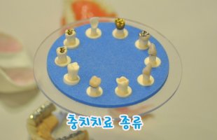 치아크라운3