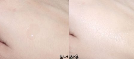 민감성피부스킨로션2