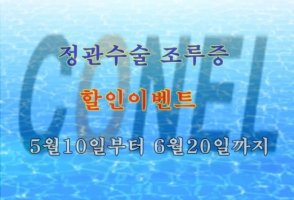 비뇨기과정관수술1