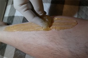 남자브라질리언왁싱2