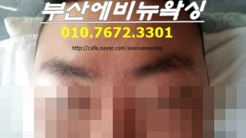 남자브라질리언왁싱3