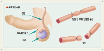 안양비뇨기과추천2