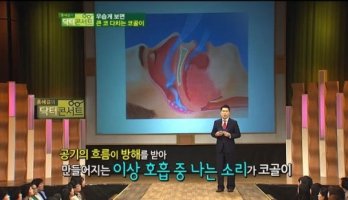 코골이스프레이2