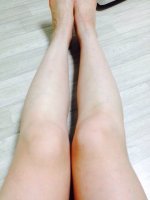 의료용압박스타킹추천3