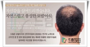 모발이식부작용5
