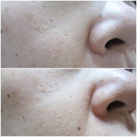 오일프리화장품5