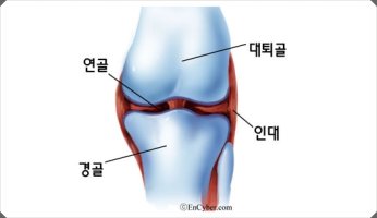 인공관절의 역사, 인공관절의 수술과 수술 후 관리방법