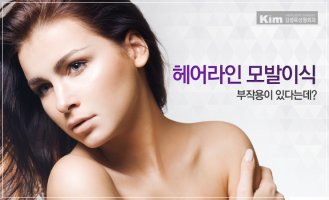 모발이식부작용4