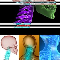 강남구신경외과5