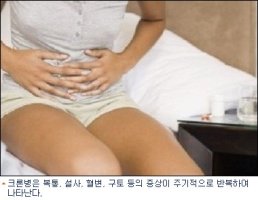 대장질환3