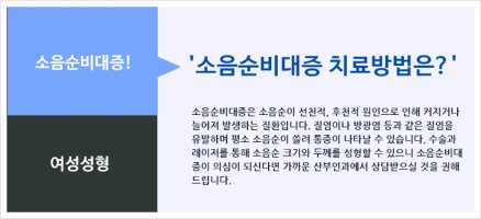 비대칭소음순1