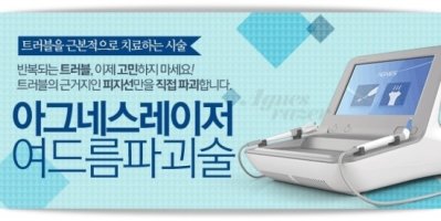 여드름레이저치료4