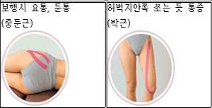 테이핑2