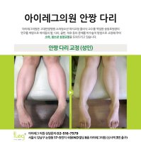 X자다리교정기1